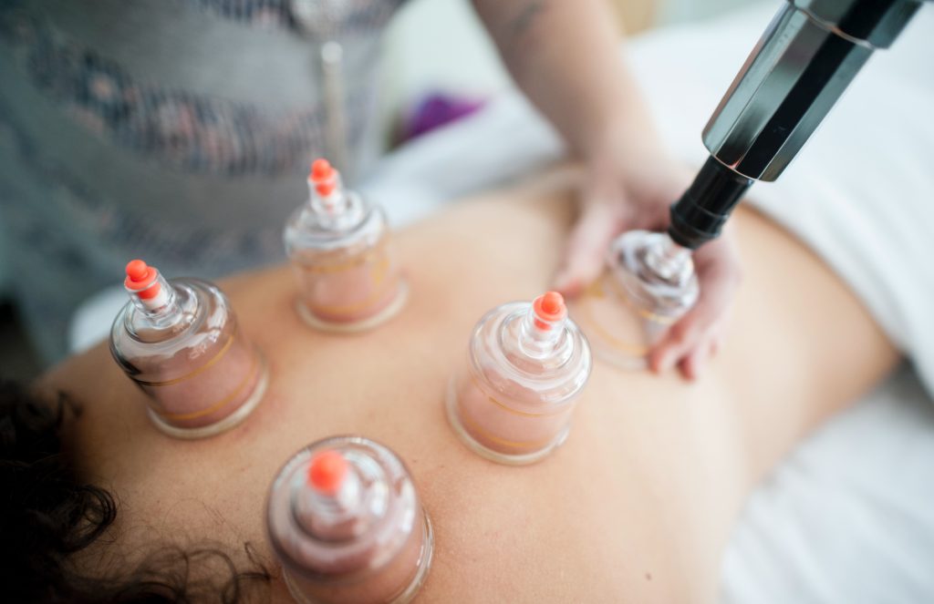 Cupping therapy on patient