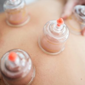 Cupping therapy on patient